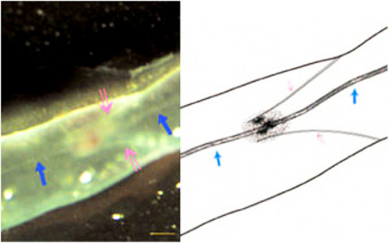 C-fibre Nerves / Meridians